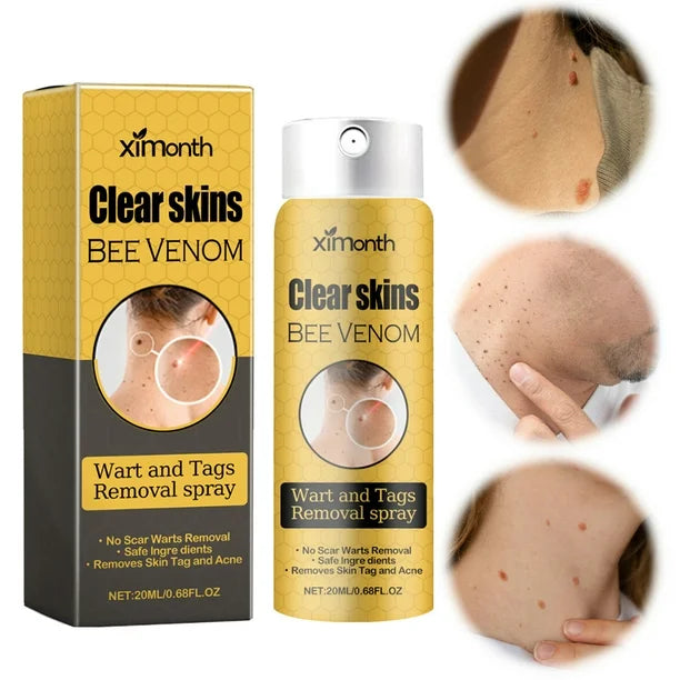 Eliminador de Verrugas y Lunares