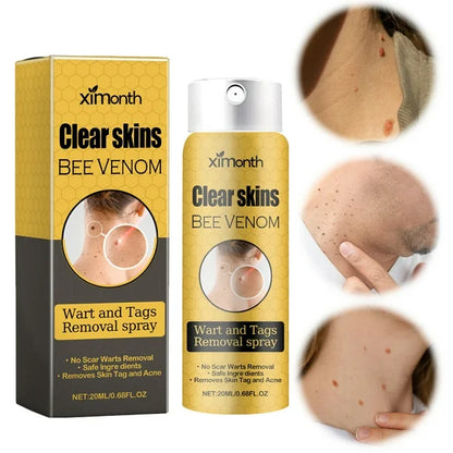 Eliminador de Verrugas y Lunares